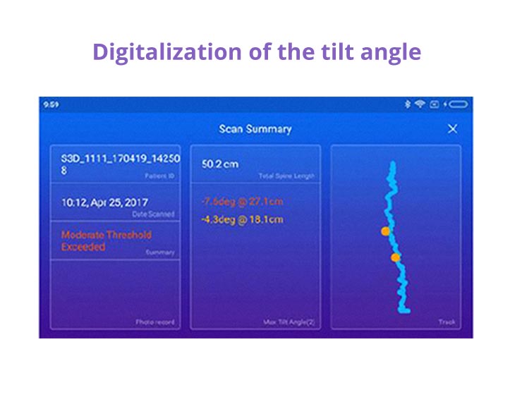 Digitalization of the tilt angle